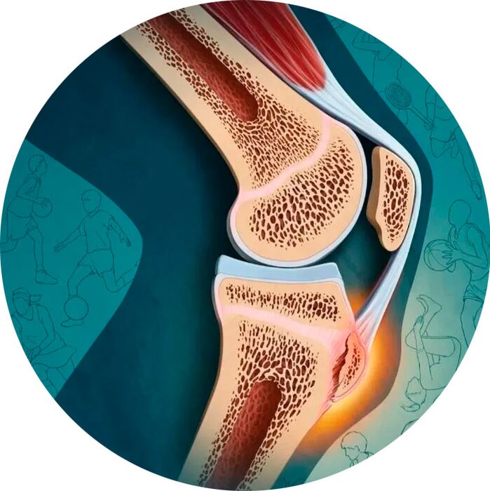 De structuur van het gewricht en de omliggende weefsels