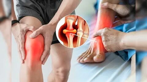 Huidgebieden die geschikt zijn voor het aanbrengen van Icexin-gel (knieën, ellebogen, onderrug)