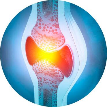 gewrichtsherstelproces met Icexin-gel