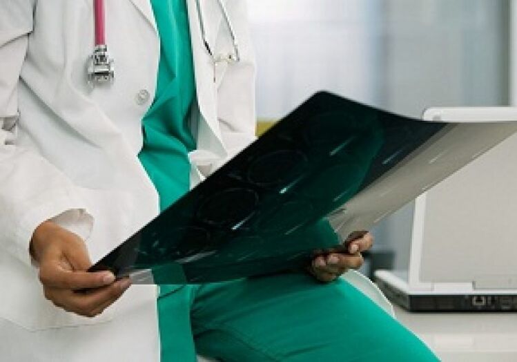 Röntgenfoto's zullen de arts helpen bij het diagnosticeren van osteochondrose van de thoracale wervelkolom