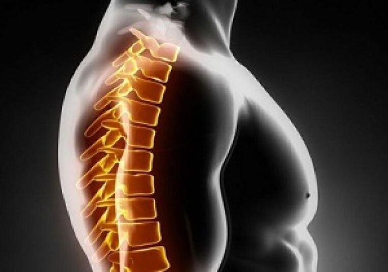 Thoracale osteochondrose gaat gepaard met pijn en ongemak in het midden van de rug