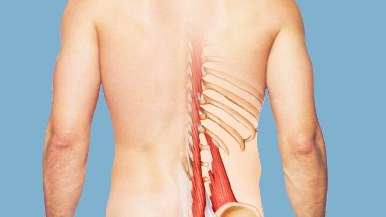 myositis als oorzaak van lage rugpijn